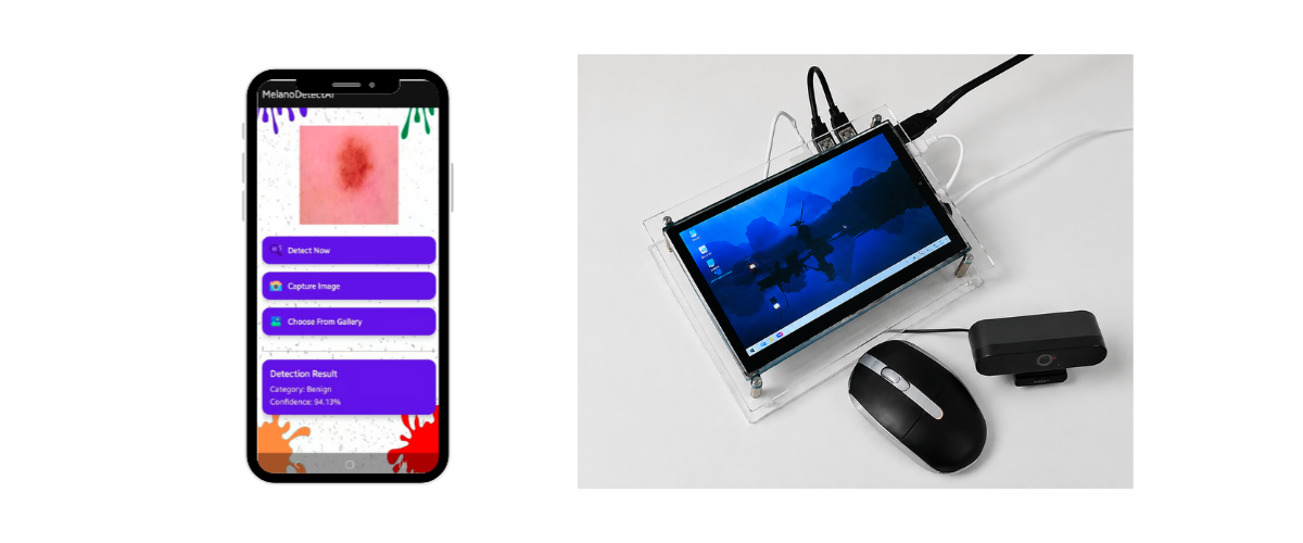 MelanoDetect AI